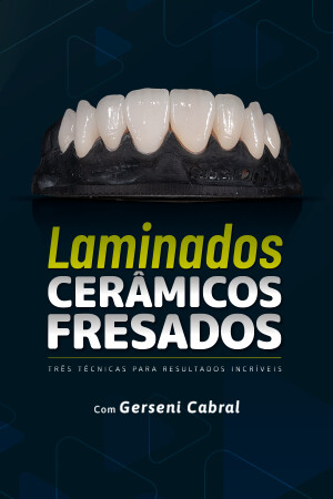 Laminados Cerâmicos Fresados