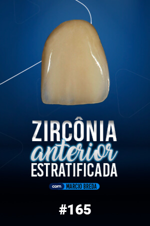 Zircônia Anterior Estratificada