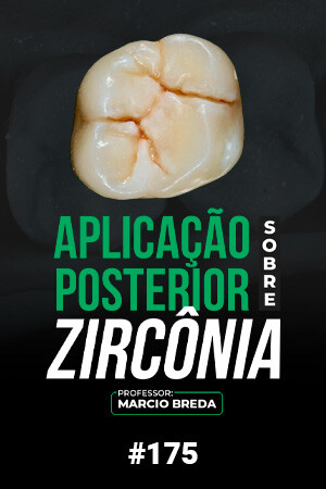 Aplicação Posterior Sobre Zircônia